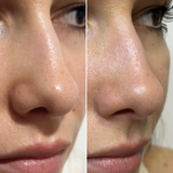 DUO PORES NETS