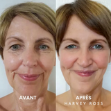Hervey Ross - Instant Lift +