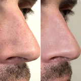 DUO PORES NETS